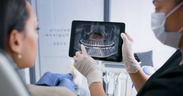 Licensed Root Canal Treatment service in Woodfield, SC - Smile Center Dentistry